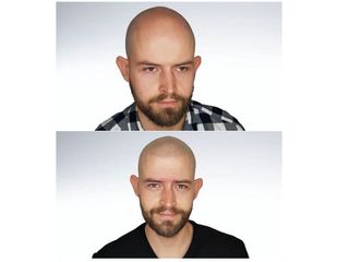 Przed i  po - mikropigmentacja