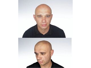 Przed i po - mikropigmentacja