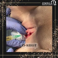 O-Shot - OMEGA Estetica