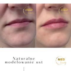 Delikatne modelowanie ust.