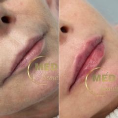 Delikatne modelowanie ust