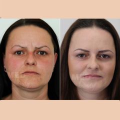 Bardzo delikatne modelowanie twarzy