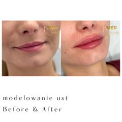 Modelowanie ust
