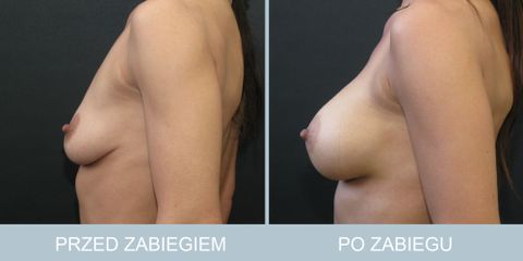 piersi_22