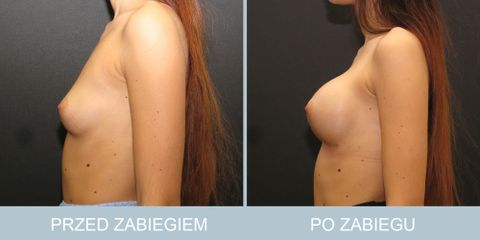 piersi_26