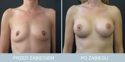 piersi_70