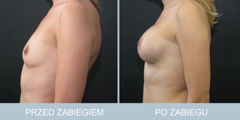 piersi_72