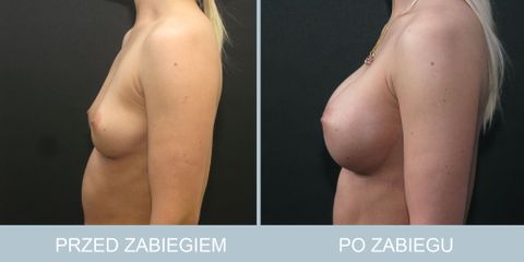 piersi_82