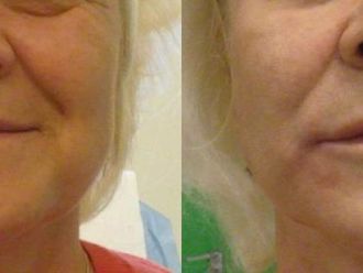 Anti aging - medycyna przeciwstarzeniowa - 653719