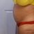 Koszmarna liposukcja w DERMED-zdjecia po