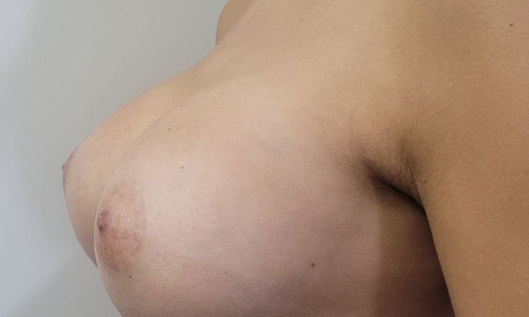 135080