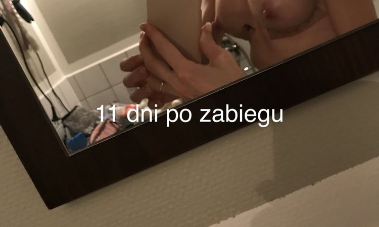 81496