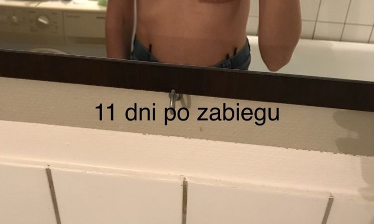 81497
