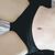 Polecam bardzo pełną abdominoplastykę :) 