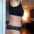 Abdominoplastyka i zaopatrzenie przepukliny - dr Paciorek