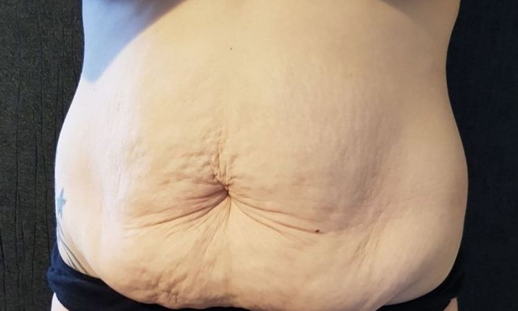 16944