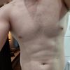 Liposukcja i jej RODZAJE / kriolipoliza