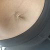 Pępek po kolczyku i ciąży