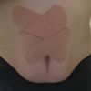 Czy abdominoplastyka jest u mnie wskazana? Polecanie specjaliści w Krakowie