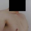 Klatka szewska u mężczyzny - czym wypełnić?