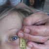 Jak postępować z blizną (kąsana) na twarzy sześciolatki - 9981