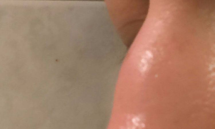 Krzywa przegroda i usunięcie garbka - Poznań - 10302