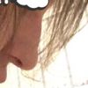 Korekta nosa - możliwość uniesienia czubka nosa kwasem hialuronowym  - 10495