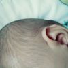 Ubytek obrąbka uszu u 3 miesięcznego chłopca - 10617