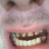 Co zrobić z moimi strasznymi zębami :D  - 10757