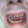 Co zrobić z moimi strasznymi zębami :D  - 10758