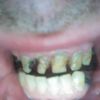 Co zrobić z moimi strasznymi zębami :D  - 10759