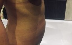 Podniesienie piersi - lifting z implantami czy bez - 10787