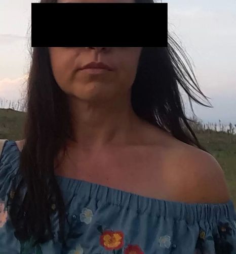 Opadający dół twarzy, ciężka nalana kwadratowa twarz - czy możliwe jest osiągnie