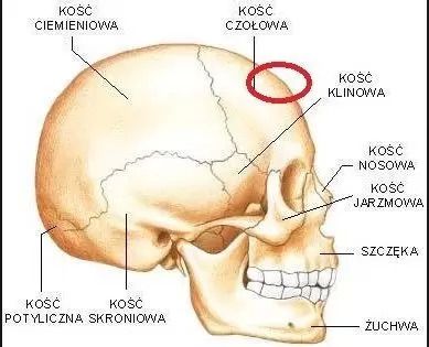 Uwypuklenie nad czołem - 10959