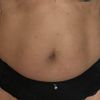 Body jet brzuch i boki
