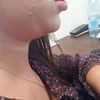 Jaka metoda usunięcia podwójnego podbródka?