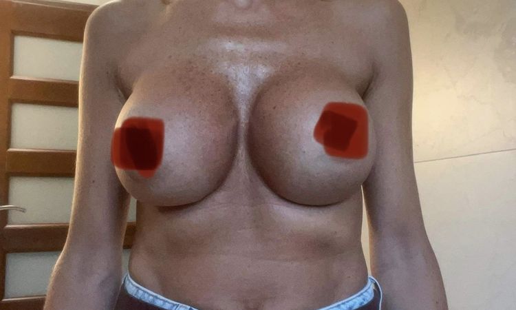 Co można zrobić z przeciętym mięśniem piersiowym? - 56787