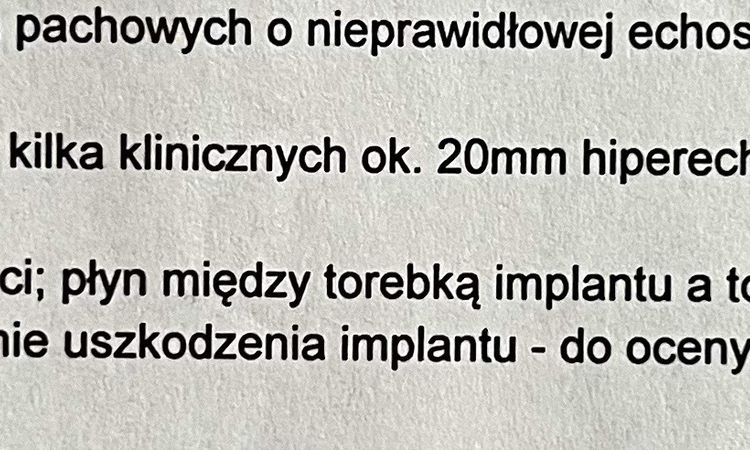 Podejrzenie silikonu w węzłach chłonnych po pęknięciu implantu. - 57904