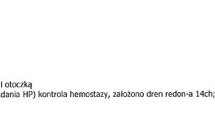 Czy możliwa jest liposukcja po ginekomastii? - 58720