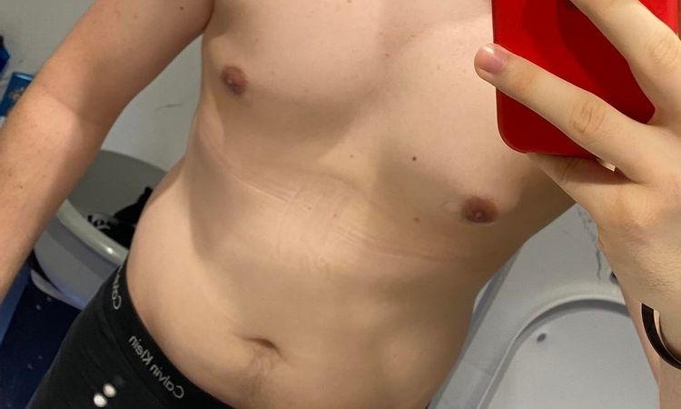 Czy możliwa jest liposukcja po ginekomastii? - 58722