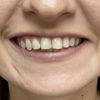 Asymeria twarzy ortodoncja wada zgryzu