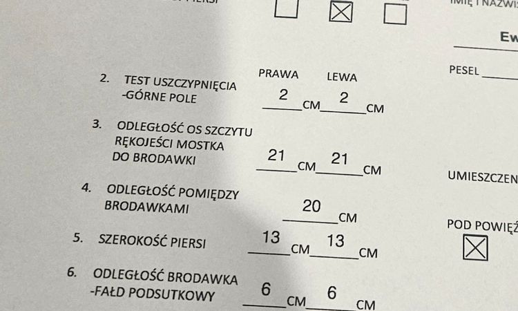 Konsultacja wyboru implantu - 83368