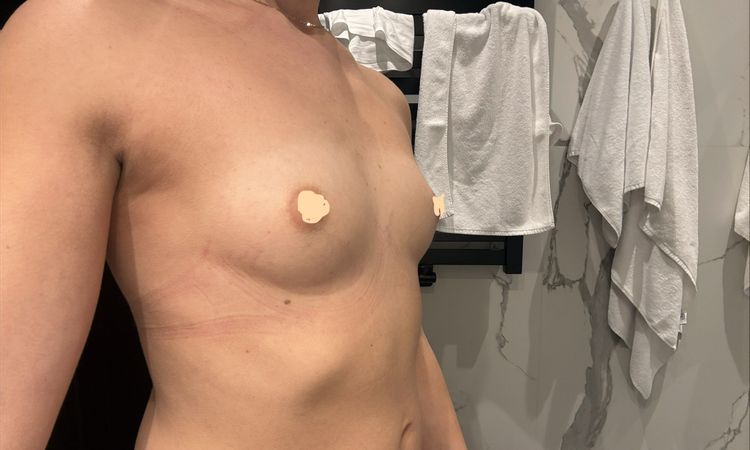 Dlaczego sutki są tak wysoko? - 85019