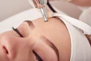 Przebieg zabiegu mikrodermabrazji