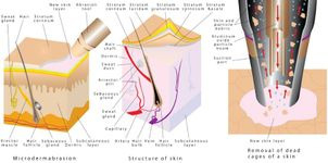 Mechanizm mikrodermabrazji