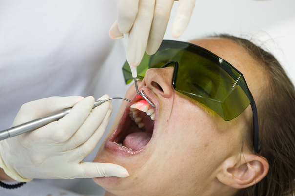 Laser biostymulujący w stomatologii
