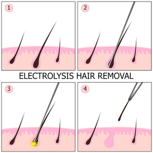 Działanie elektrolizy