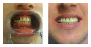 Metamorfoza uśmiechu