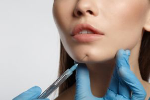 Korekcja podbródka kwasem hialuronowym