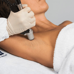 Depilacja laserowa pach